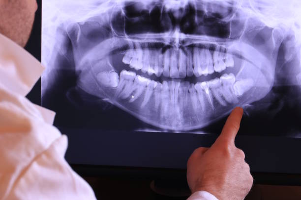 Best Emergency Dental Care for Sports Injuries in Garden City, SC