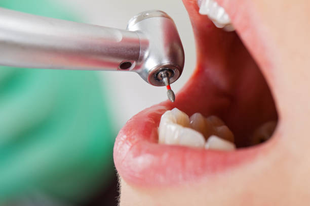 Best Broken or Chipped Tooth Repair in Garden City, SC